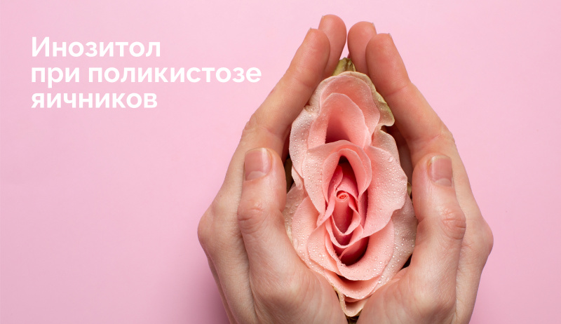 Роль мио-инозитола в терапии синдрома поликистозных яичников (СПКЯ)